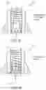 Fig. 17 - PAIN-REDUCING INSERTION APPARATUS AND USES THEREOF