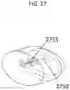 Fig. 28 - PAIN-REDUCING INSERTION APPARATUS AND USES THEREOF