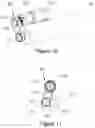 Fig. 10 - POSITIVE DISPLACEMENT VENTILATOR FOR BREATHING ASSIST