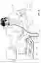 Fig. 03 - CONDUIT HEADGEAR
