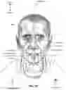 Fig. 07 - CONDUIT HEADGEAR