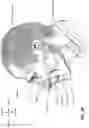 Fig. 08 - CONDUIT HEADGEAR