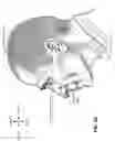 Fig. 09 - CONDUIT HEADGEAR