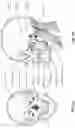 Fig. 12 - CONDUIT HEADGEAR
