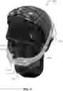 Fig. 20 - CONDUIT HEADGEAR