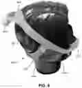 Fig. 22 - CONDUIT HEADGEAR