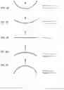 Fig. 04 - VENTS FOR PATIENT INTERFACES