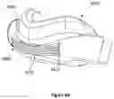 Fig. 22 - VENTS FOR PATIENT INTERFACES