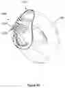 Fig. 23 - VENTS FOR PATIENT INTERFACES