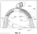 Fig. 15 - Textile conduit with windows