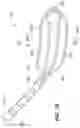 Fig. 03 - Layered High Density Electrode Mapping Catheter