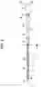 Fig. 05 - STYLET FOR A PERCUTANEOUS CATHETER