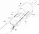 Fig. 01 - DEVICE FOR SECURING A CATHETER