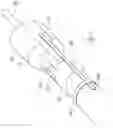 Fig. 05 - DEVICE FOR SECURING A CATHETER
