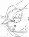 Fig. 07 - Vascular Access Systems and Methods Thereof