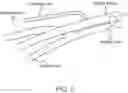 Fig. 04 - TRANSVASCULAR ACCESS METHODS