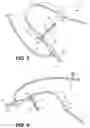 Fig. 04 - Sheath
