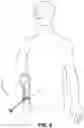 Fig. 08 - Sheath
