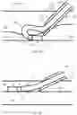 Fig. 08 - GUIDEWIRE WITH ELASTICALLY ARTICULATABLE TIP