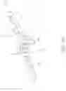 Fig. 30 - MEDICAL BALLOON CATHETERS WITH ENHANCED PUSHABILITY