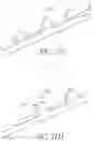 Fig. 34 - MEDICAL BALLOON CATHETERS WITH ENHANCED PUSHABILITY