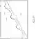 Fig. 51 - MEDICAL BALLOON CATHETERS WITH ENHANCED PUSHABILITY