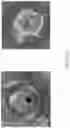 Fig. 73 - MEDICAL BALLOON CATHETERS WITH ENHANCED PUSHABILITY