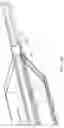 Fig. 84 - MEDICAL BALLOON CATHETERS WITH ENHANCED PUSHABILITY
