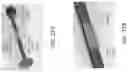 Fig. 36 - DEVICES, SYSTEMS, AND METHODS FOR BLOOD FLOW CONTROL