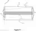 Fig. 10 - Reinforced balloon catheter