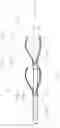 Fig. 07 - SHUNT DEVICE AND A METHOD FOR SHUNTING CEREBROSPINAL FLUID