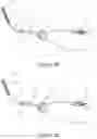 Fig. 04 - DELIVERY DEVICE FOR EUSTACHIAN TUBE PROCEDURES