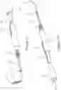 Fig. 17 - DELIVERY DEVICE FOR EUSTACHIAN TUBE PROCEDURES