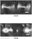 Fig. 04 - Methods For Making Microneedles Using Adjustment Of Component Solubility In Casting Formulations