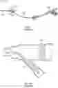 Fig. 02 - PERIPHERAL INTRAVENOUS CATHETERS HAVING FLOW DIVERTING FEATURES