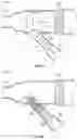 Fig. 07 - PERIPHERAL INTRAVENOUS CATHETERS HAVING FLOW DIVERTING FEATURES