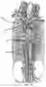 Fig. 03 - SYSTEMS AND METHODS FOR SELECTIVELY OCCLUDING THE SUPERIOR VENA CAVA FOR TREATING HEART CONDITIONS