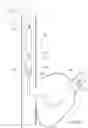 Fig. 49 - SYSTEMS AND METHODS FOR SELECTIVELY OCCLUDING THE SUPERIOR VENA CAVA FOR TREATING HEART CONDITIONS