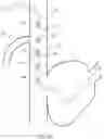 Fig. 50 - SYSTEMS AND METHODS FOR SELECTIVELY OCCLUDING THE SUPERIOR VENA CAVA FOR TREATING HEART CONDITIONS