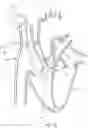 Fig. 56 - SYSTEMS AND METHODS FOR SELECTIVELY OCCLUDING THE SUPERIOR VENA CAVA FOR TREATING HEART CONDITIONS