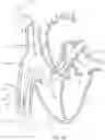 Fig. 57 - SYSTEMS AND METHODS FOR SELECTIVELY OCCLUDING THE SUPERIOR VENA CAVA FOR TREATING HEART CONDITIONS
