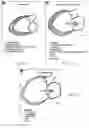Fig. 62 - SYSTEMS AND METHODS FOR SELECTIVELY OCCLUDING THE SUPERIOR VENA CAVA FOR TREATING HEART CONDITIONS