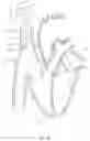 Fig. 63 - SYSTEMS AND METHODS FOR SELECTIVELY OCCLUDING THE SUPERIOR VENA CAVA FOR TREATING HEART CONDITIONS