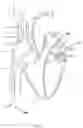 Fig. 67 - SYSTEMS AND METHODS FOR SELECTIVELY OCCLUDING THE SUPERIOR VENA CAVA FOR TREATING HEART CONDITIONS