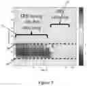 Fig. 03 - Non-invasive brain stimulation