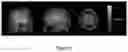 Fig. 04 - Non-invasive brain stimulation
