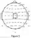 Fig. 06 - Non-invasive brain stimulation