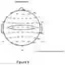 Fig. 10 - Non-invasive brain stimulation