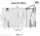 Fig. 13 - Non-invasive brain stimulation
