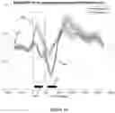 Fig. 51 - Non-invasive brain stimulation